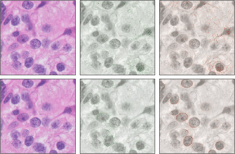A matched comparison of Integrated Gradients maps for the ordinary augmented baseline and the proposed method.
